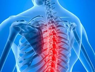 Osteochondrosis of the thoracic spine