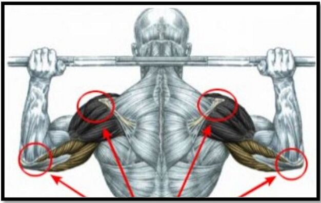 The load on the shoulder and elbow muscles is one of the causes of osteoarthritis of the shoulder joint. 